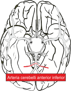 Arteria cerebelli anterior inferior