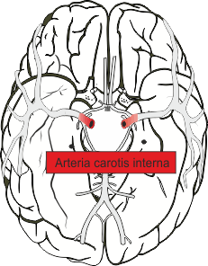 A. Corotis interna