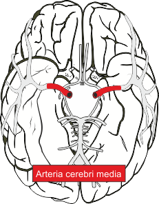 Arteria cerebri media